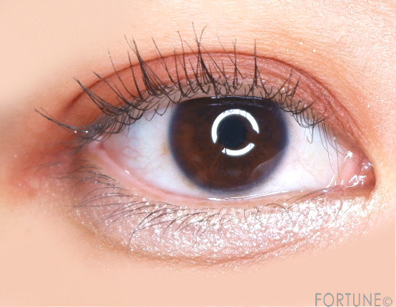 涙袋メイク　ナメクジ