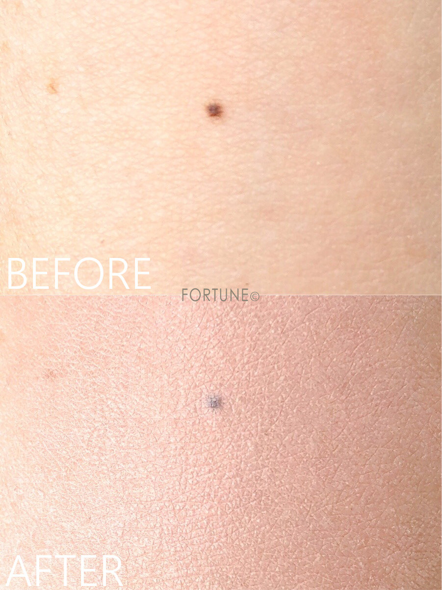 画像：2019秋冬新作「フーミー コンシーラー」ピンクベージュ