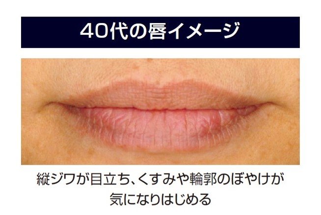 media(メディア)　ブライトアップルージュ