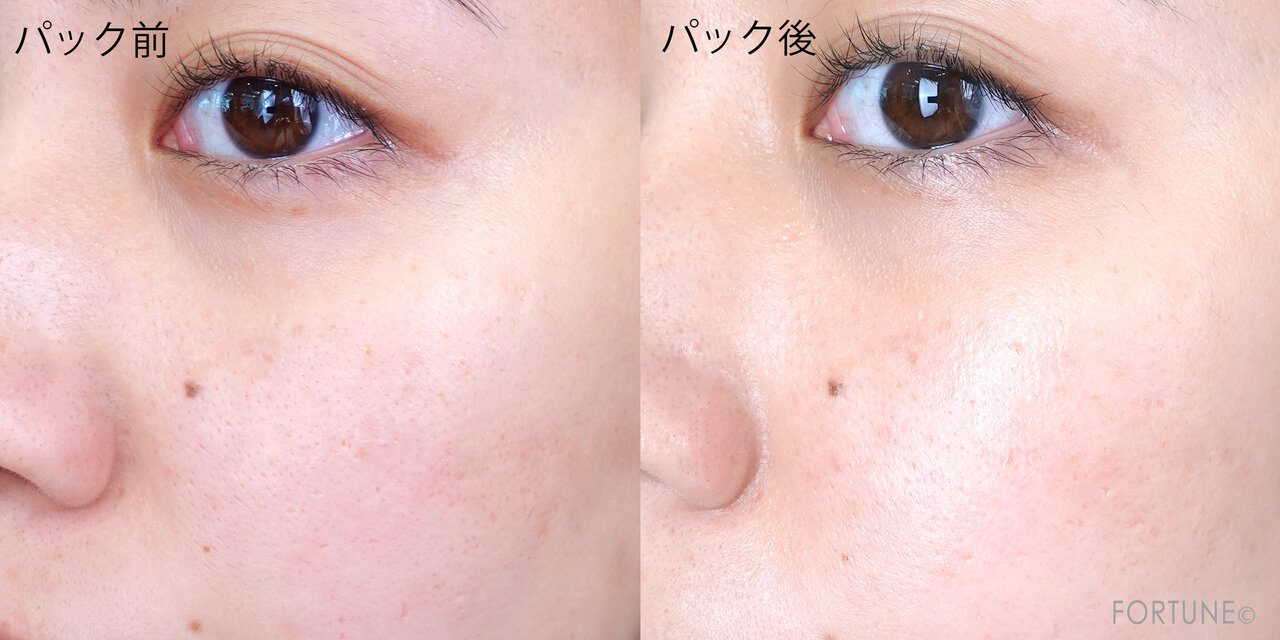 Wonjungyo（ウォンジョンヨ）　ウォンジョンヨ モイストアップレディスキンパックDM（高保湿タイプ）