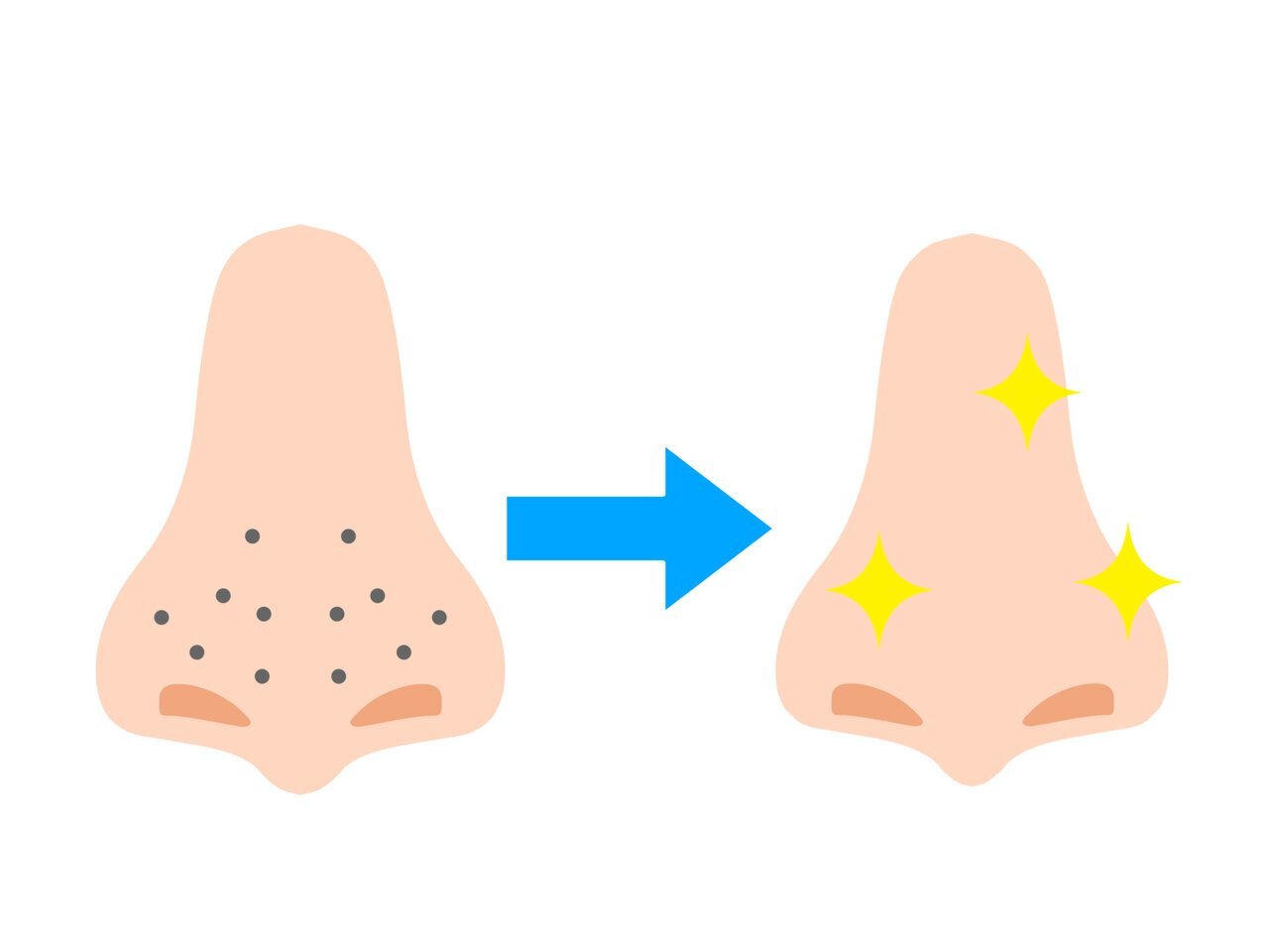 毛穴ケア　クレンジング　選び方