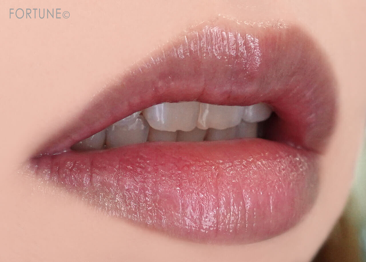 唇の乾燥・荒れ　原因