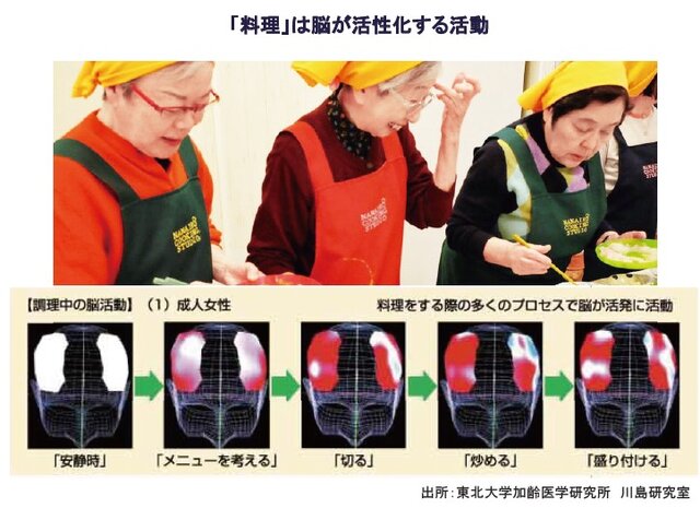 その生活習慣、脳活動を活性化する？（2）：村田裕之 - ケアニュース