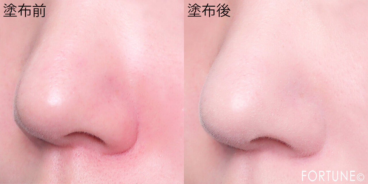 肌なやみ図鑑　　『肌なやみ図鑑 赤鼻ジェル』