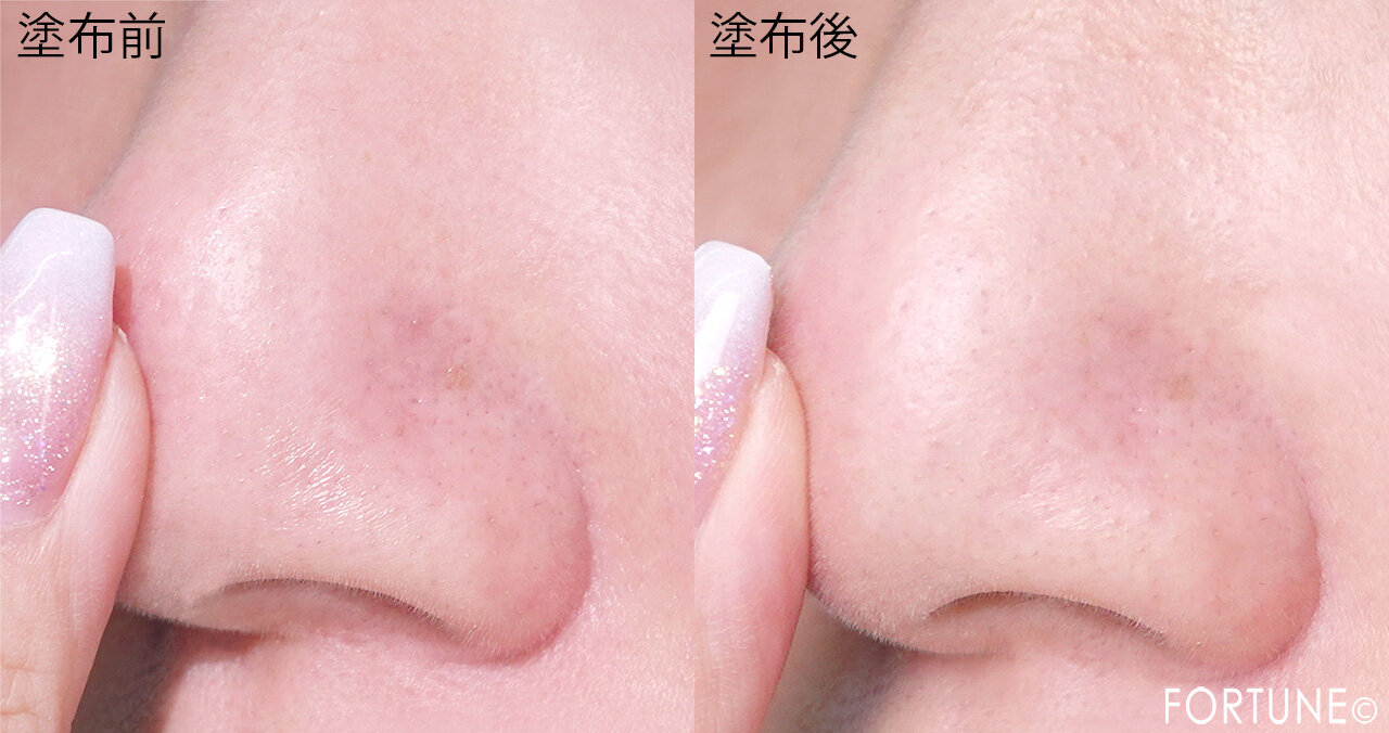 肌なやみ図鑑　　『肌なやみ図鑑 黒鼻ジェル』