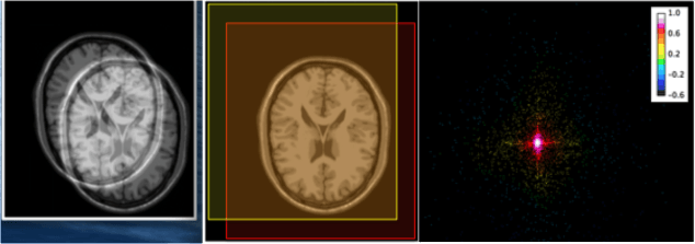医用画像位置合わせの基礎④ 〜LPixel ImageJ pluginを用いた