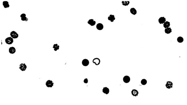 シリーズ3．ImageJマクロ言語を用いた画像解析～②二値化処理-1