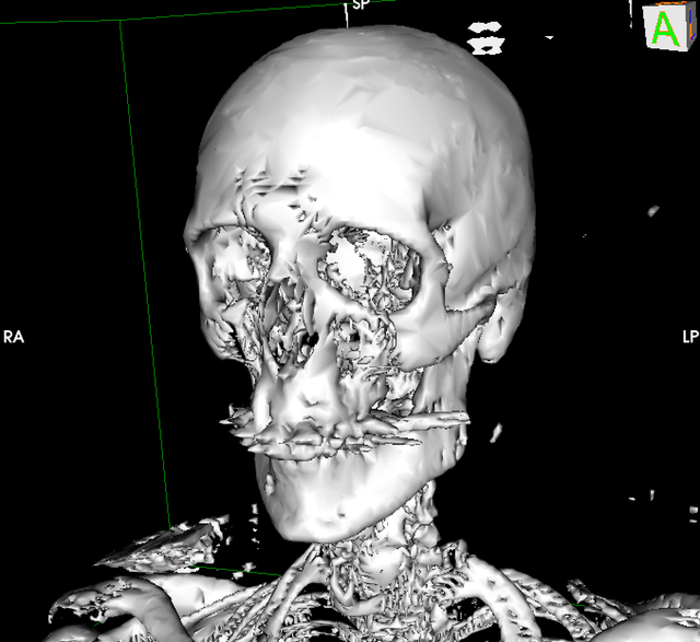 CT画像解剖・3DCT画像解析ハンドブック CT画像解剖・3DCT画像解析ハンドブック | 宮下 宗治, 山口 隆義