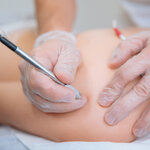 ニードル脱毛の痛みは耐えられる？後悔しないための麻酔や対策のすべて