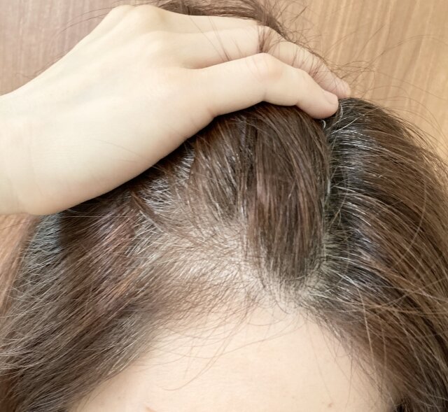 白髪を見つけたら切ったほうがいい！頭皮を傷つけずに、気になる白髪を処理する方法