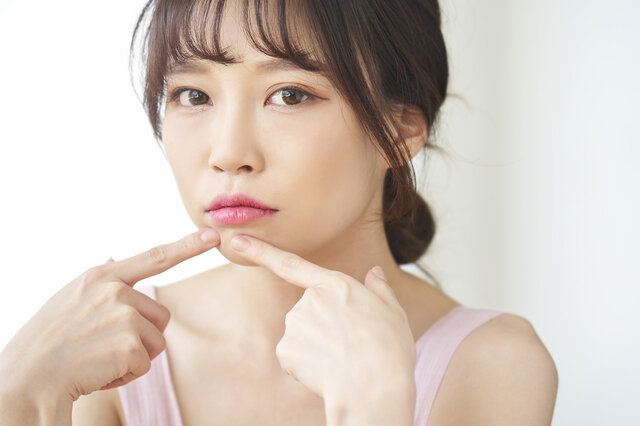 乳液はニキビを治すのに必要!プチプラ限定の乳液ベスト7!!