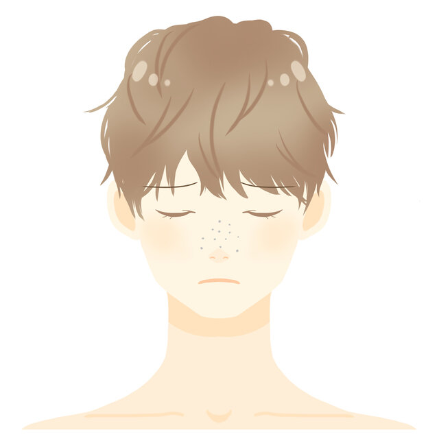 男性だって悩んでる!男性特有のいちご鼻の原因と改善方法とは?