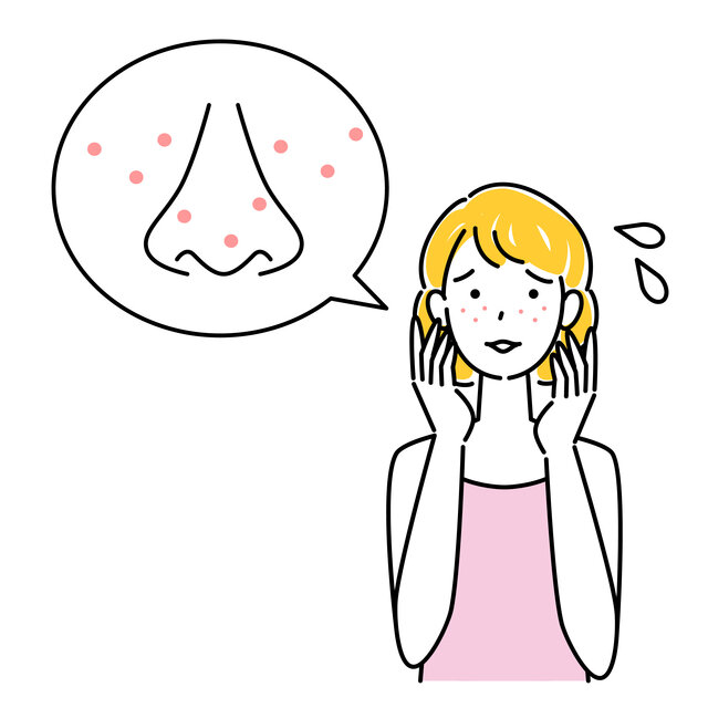 いちご鼻はクリームで保湿しながら毛穴の詰まりを撃退しよう!