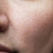 スキンケアで毛穴レスの肌を目指す方法&毛穴が目立つ原因| エイジングケア情報サイト「ビューティーエテルナ」