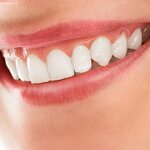 歯ぐきの腫れはなぜ起きる? 原因と対策を知り、健康的な歯ぐきを目指そう【歯科医師監修】