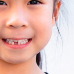 永久歯に生え変わった!　いつまでも健康的な歯でいるために、できることとは						