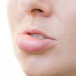 突然、唇が腫れるのはなぜ? 考えられる病気や対処法を解説