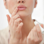 唇の乾燥は病気の可能性もある！カサカサの原因５つと対処法を紹介【医師監修】