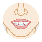 八重歯とはどんな歯?　リスクを正しく知り、適切なケアや治療を受けよう【歯科医師監修】