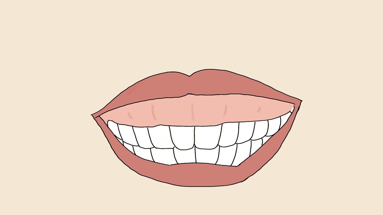 ミノカサゴに刺されたらどうすればいいですか?